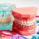 An image of dental materials orthodontic ligatures rings and ties, elastic rubber bands, and braces
