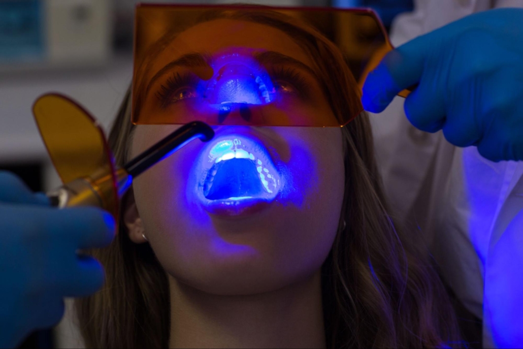 A woman at a dentist's office with her mouth open while dental professionals shine a blue light into her mouth.