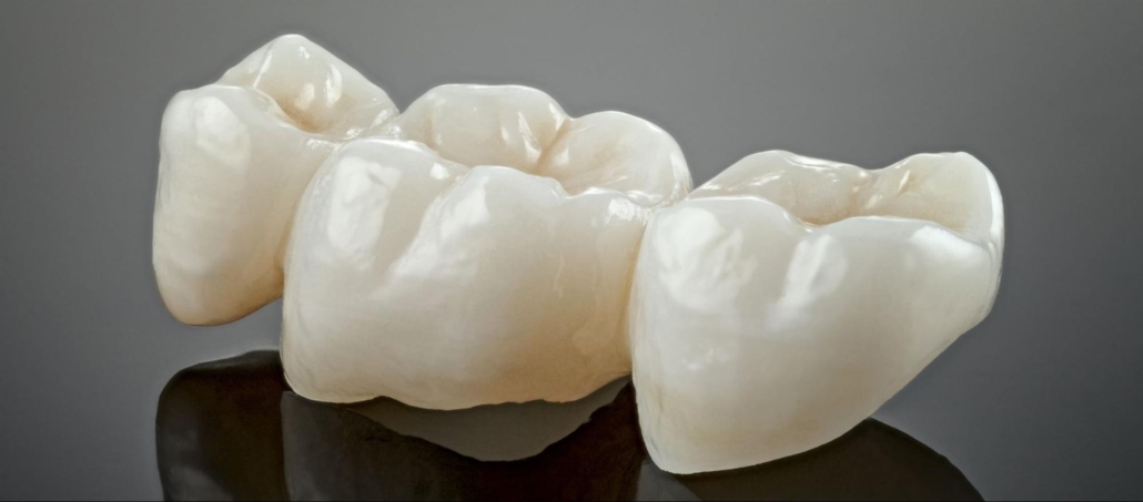 Model of dental crowns. 